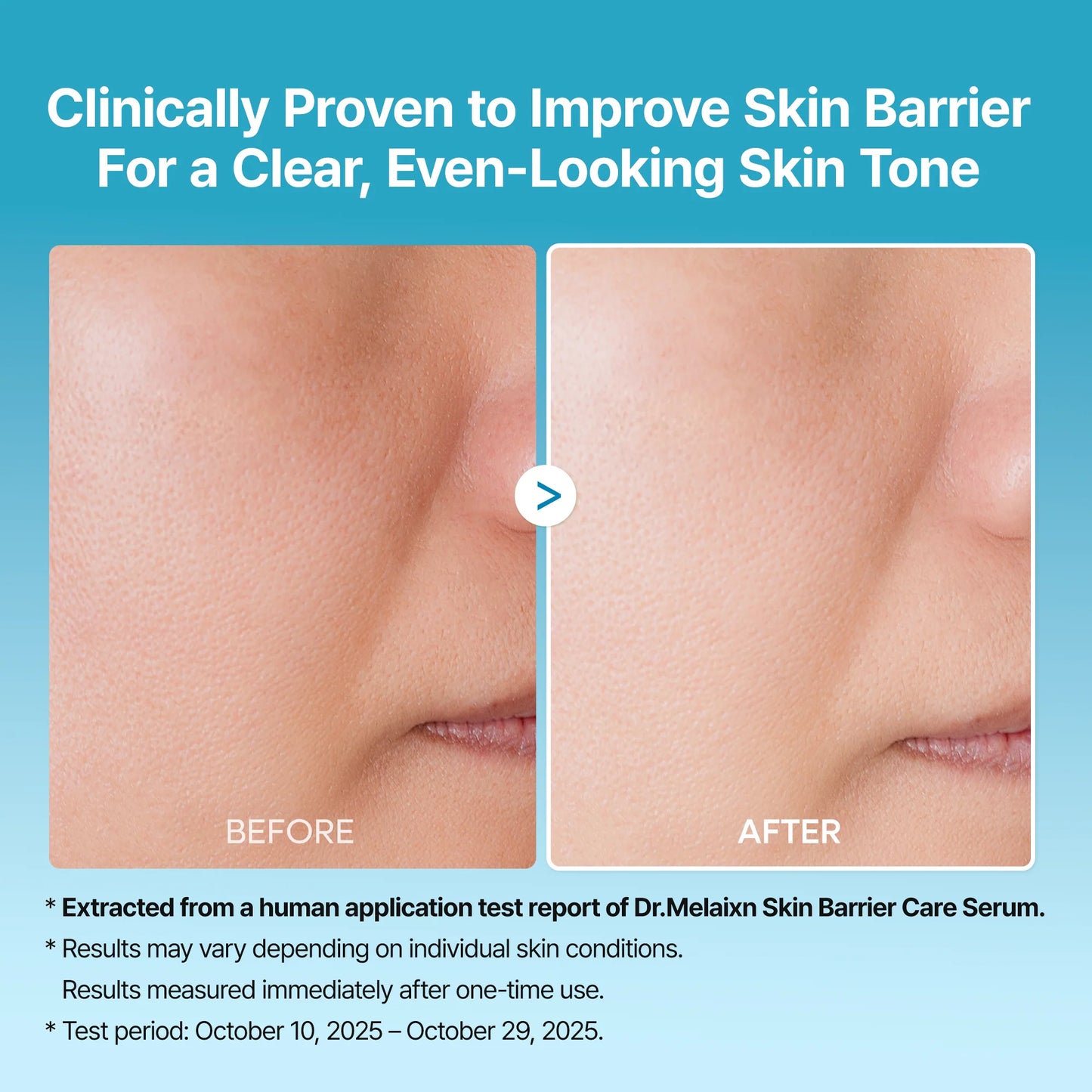 Dark Spot Exfoliating Serum